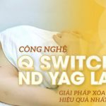 Tìm hiểu về công nghệ Q-Switched ND YAG điều trị nám bằng laser hot nhất hiện nay